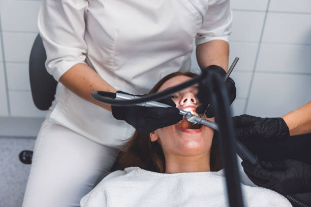Best Knocked-Out Tooth (Avulsed Tooth) Treatment in West Milton, OH